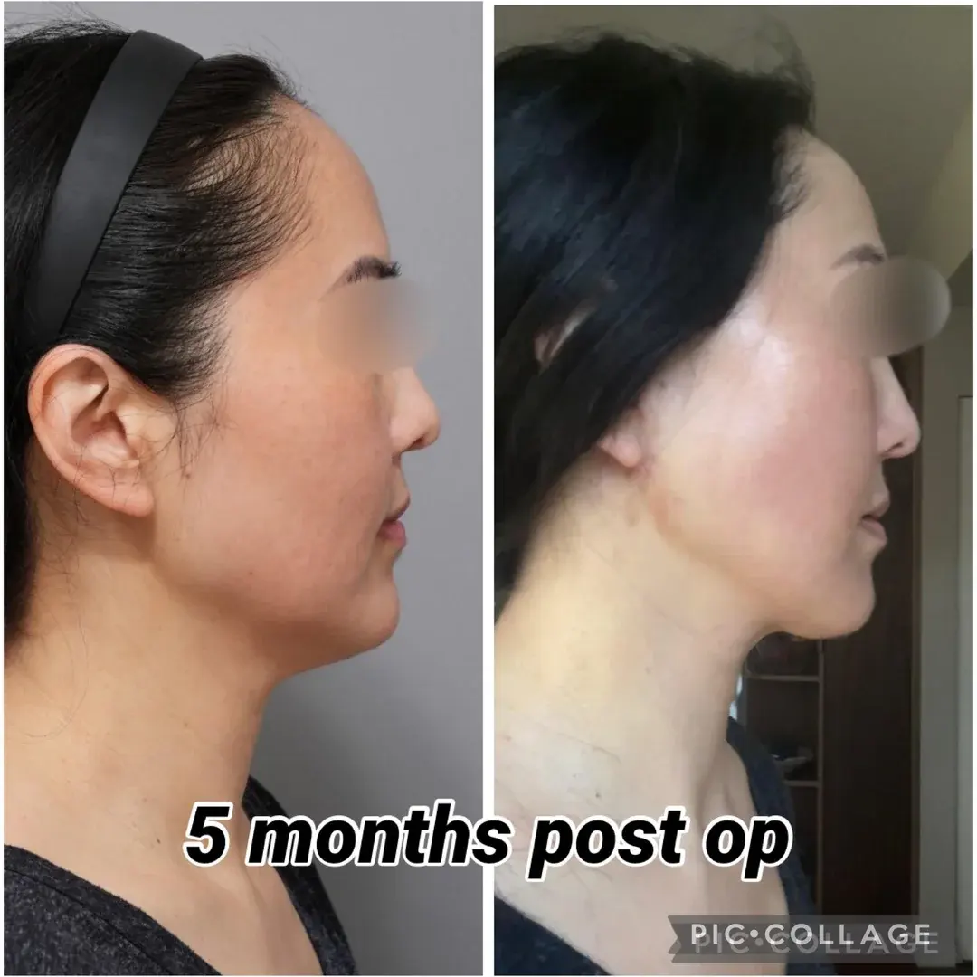 ETONNE Plastic Surgery — 3