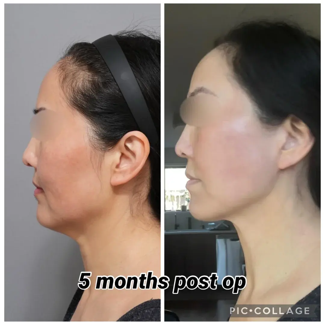 ETONNE Plastic Surgery — 4