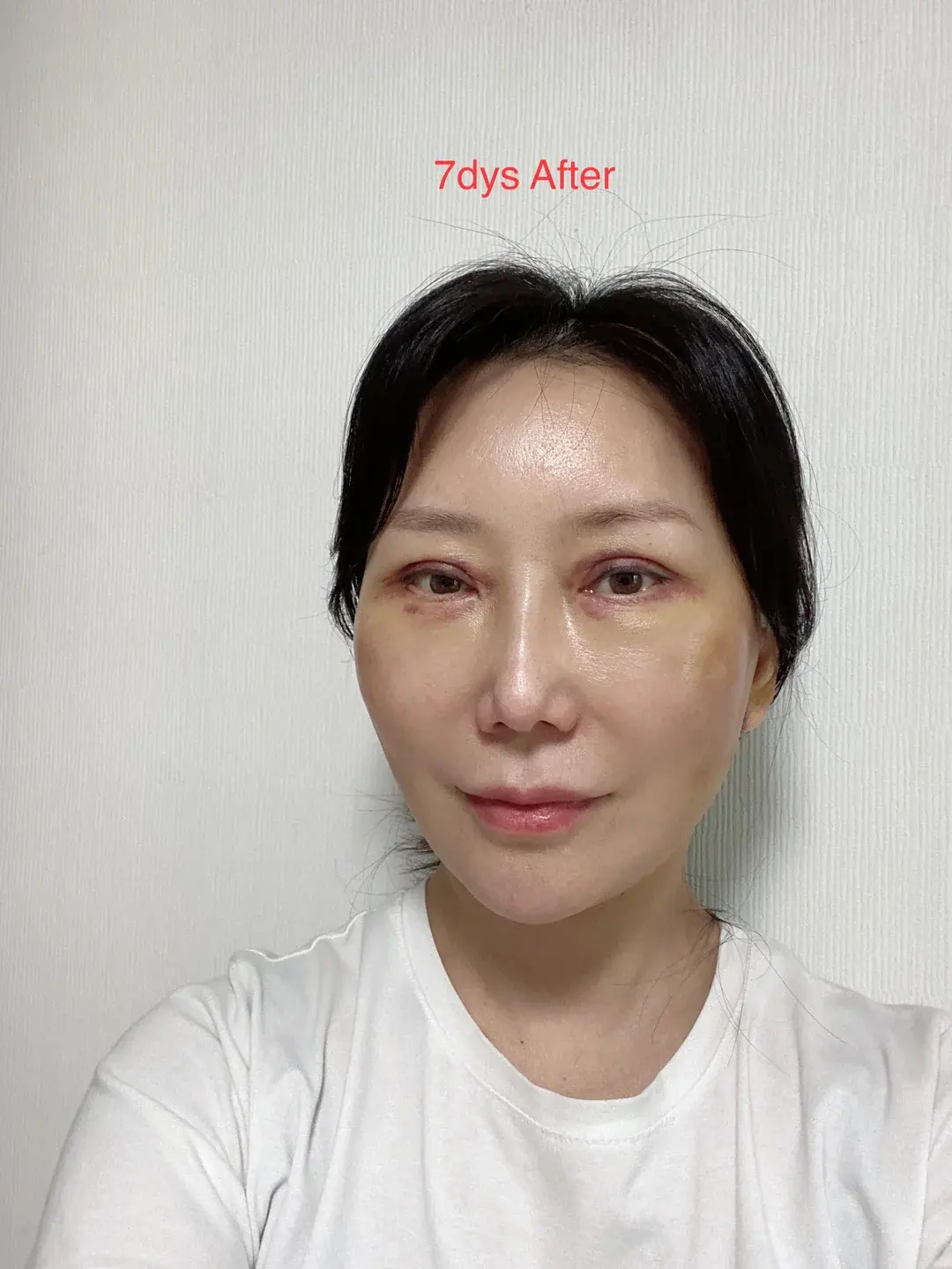 ELITE Plastic Surgery — 2