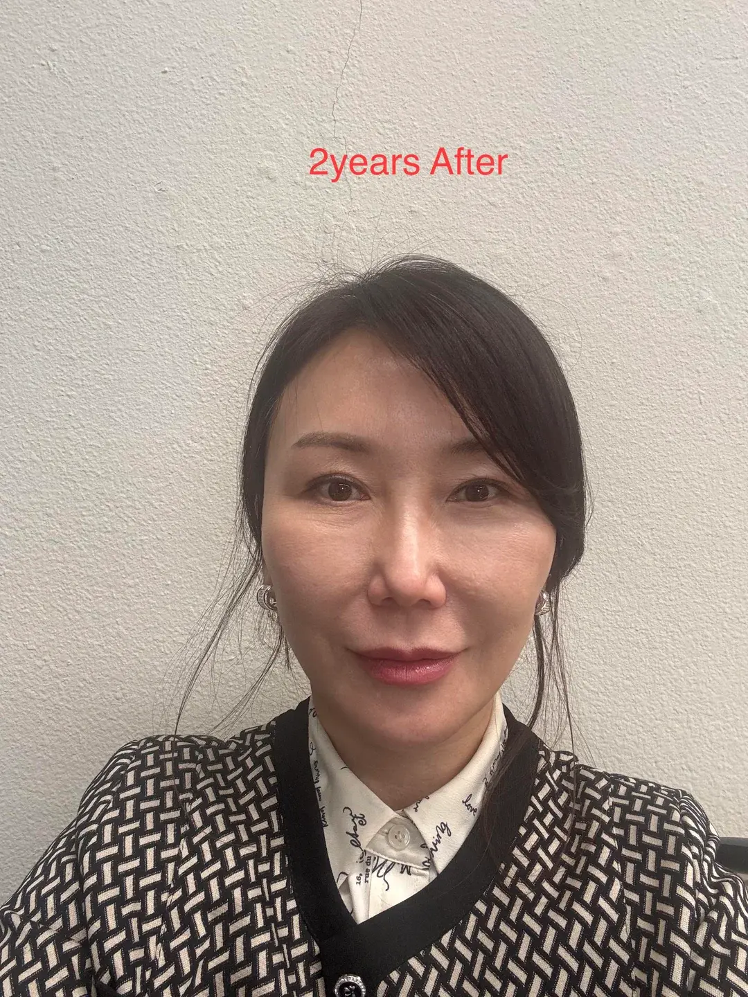 ELITE Plastic Surgery — 3