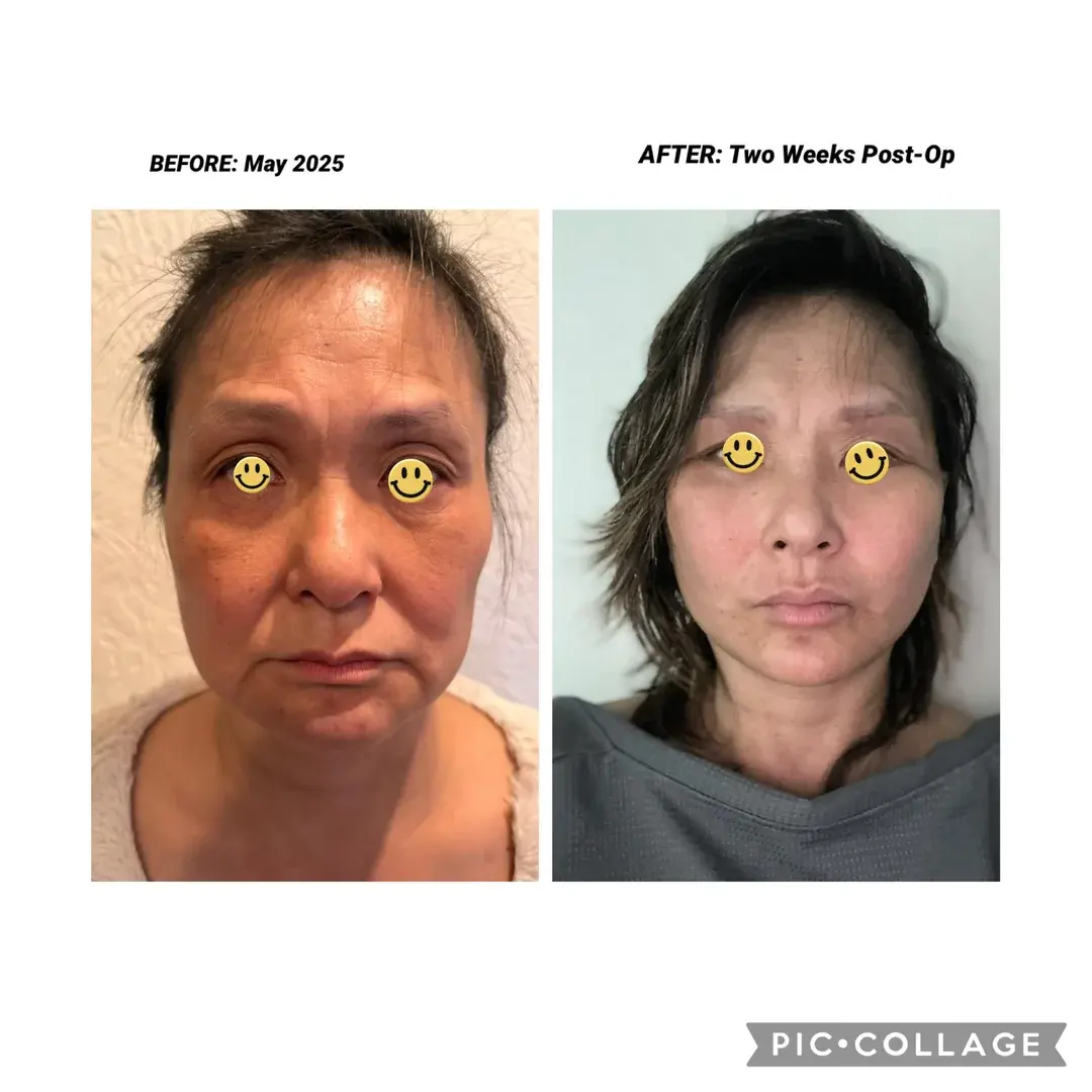 Marble Plastic Surgery — 1