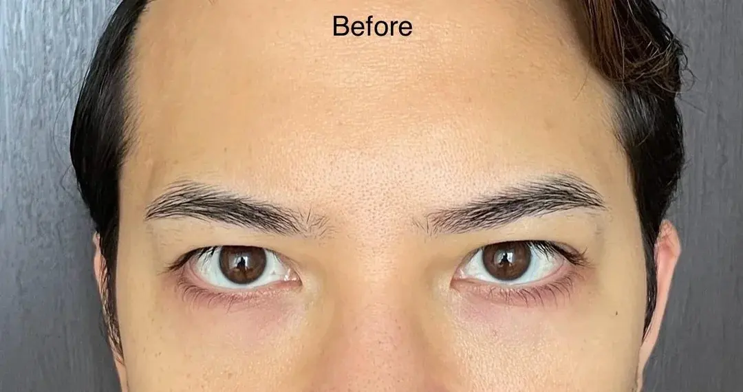 V.LIF Plastic Surgery — 1