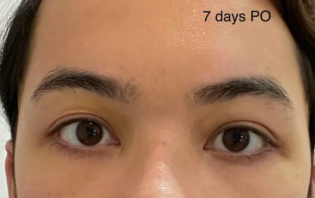 V.LIF Plastic Surgery — 2
