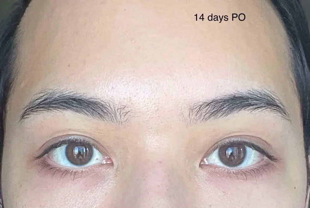 V.LIF Plastic Surgery — 3