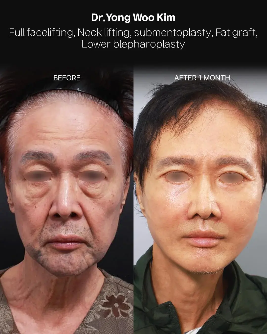 RETURNING Plastic Surgery — 1