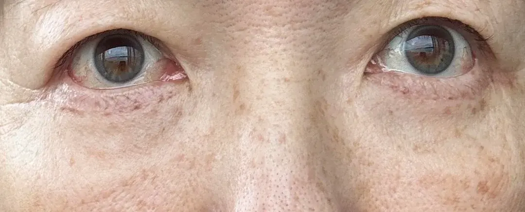 AB Plastic Surgery — 3