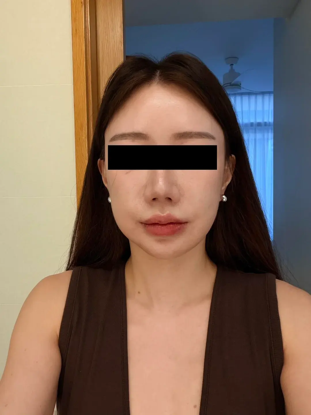 Dasipium Plastic Surgery — 1
