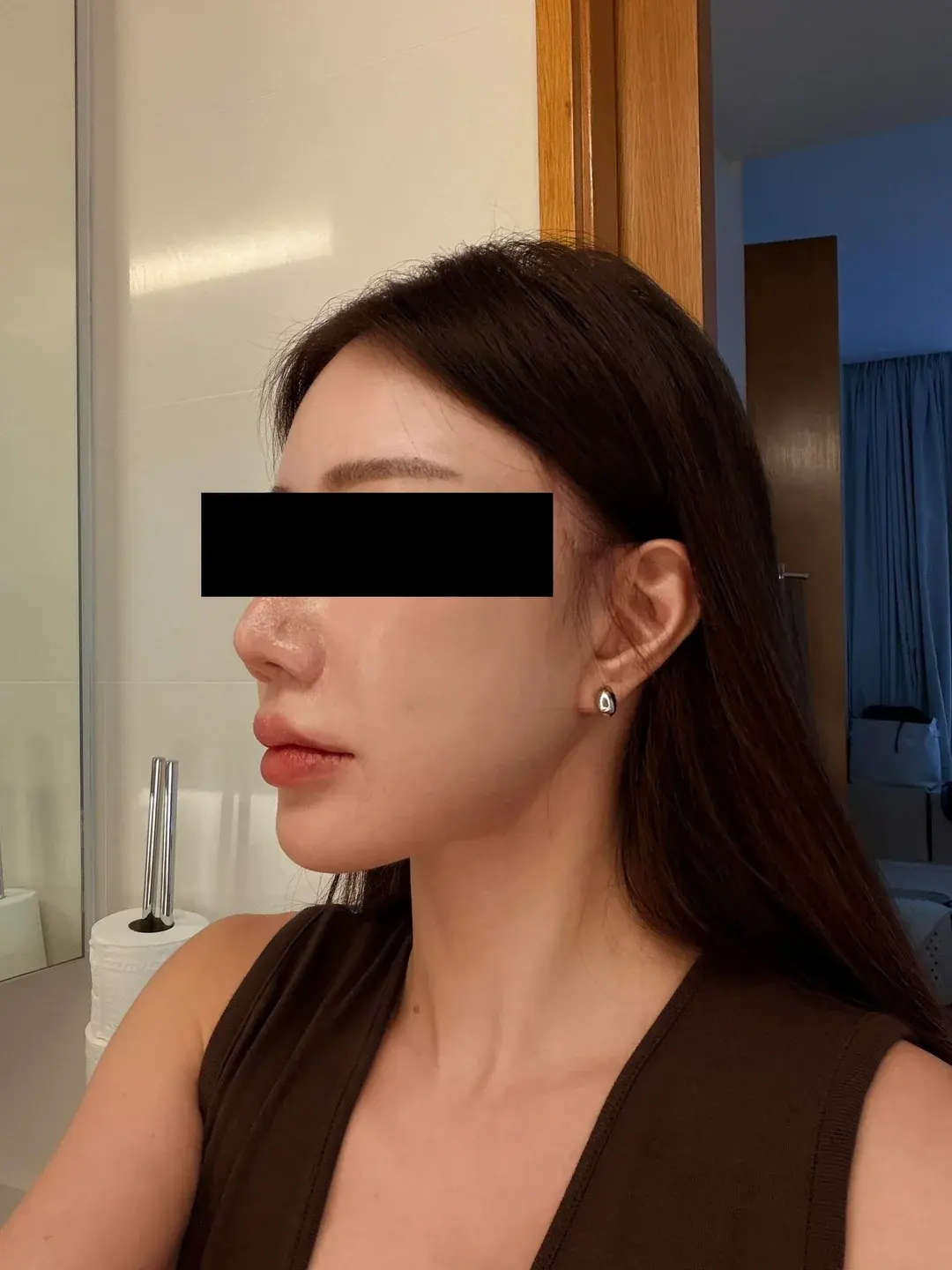 Dasipium Plastic Surgery — 3