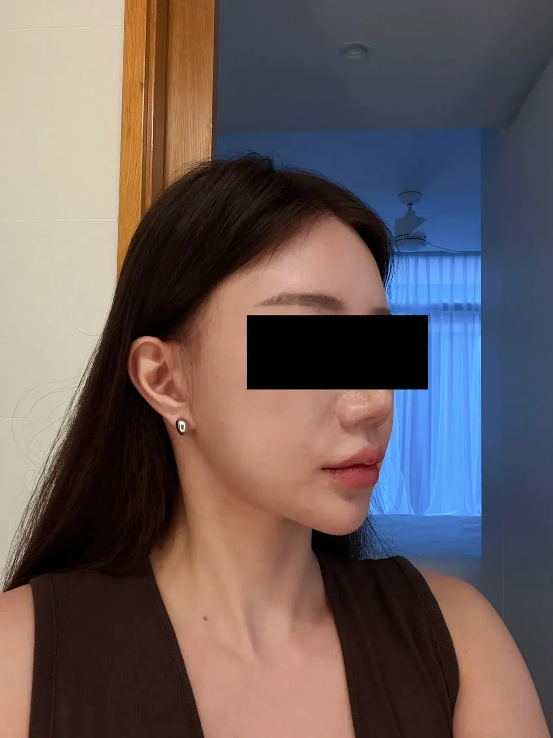 Dasipium Plastic Surgery — 4