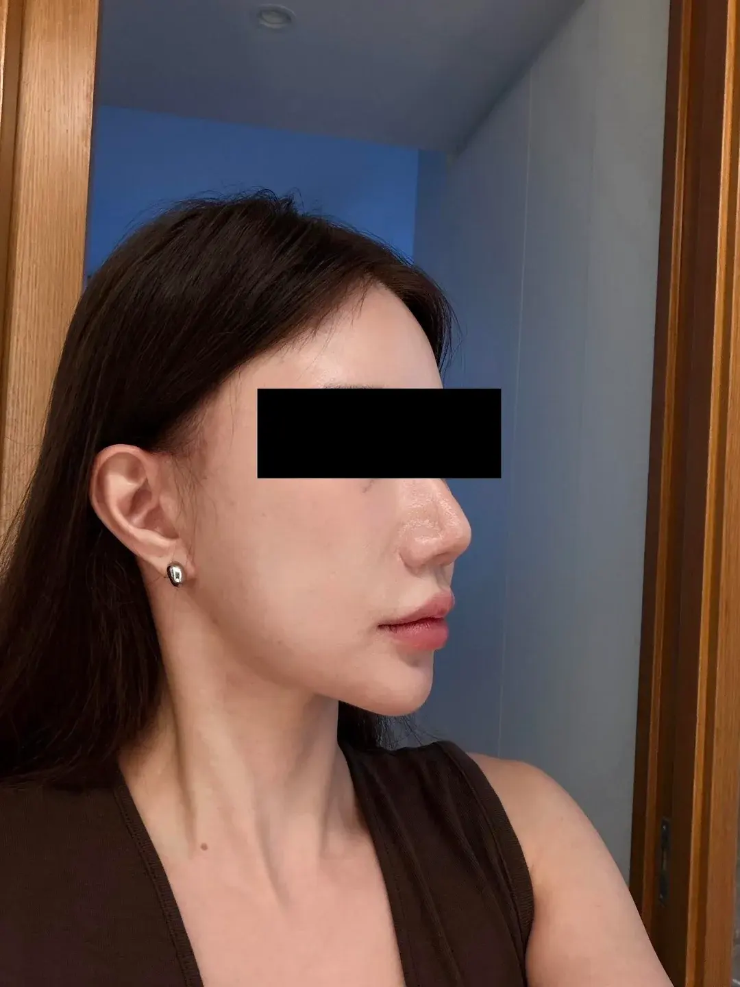 Dasipium Plastic Surgery — 5