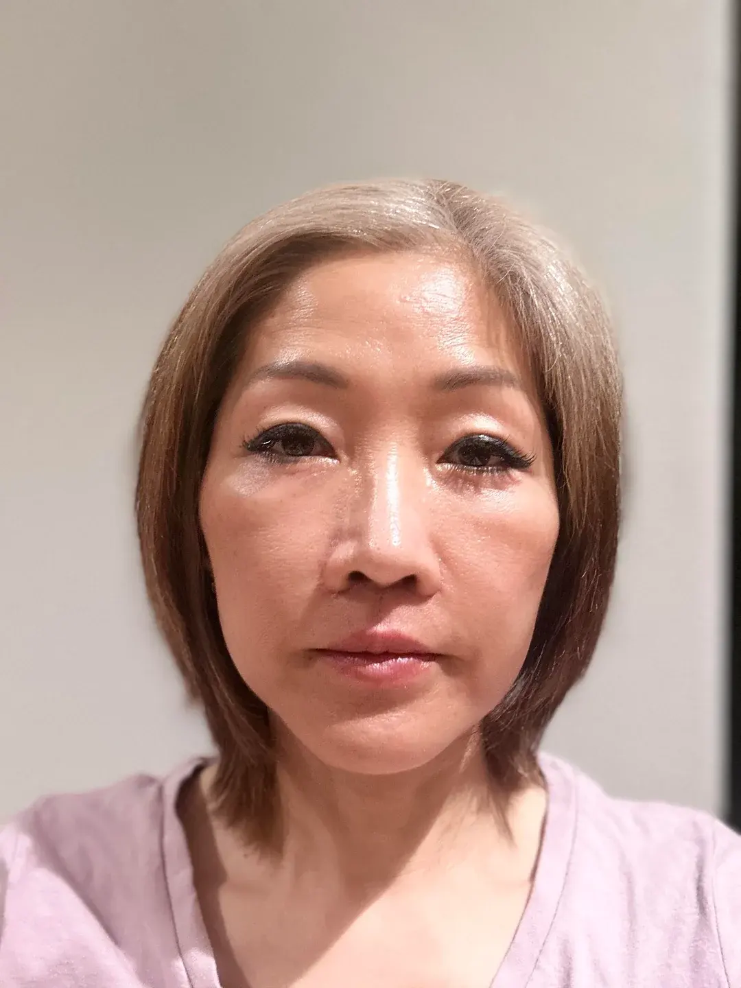 AB Plastic Surgery — 2