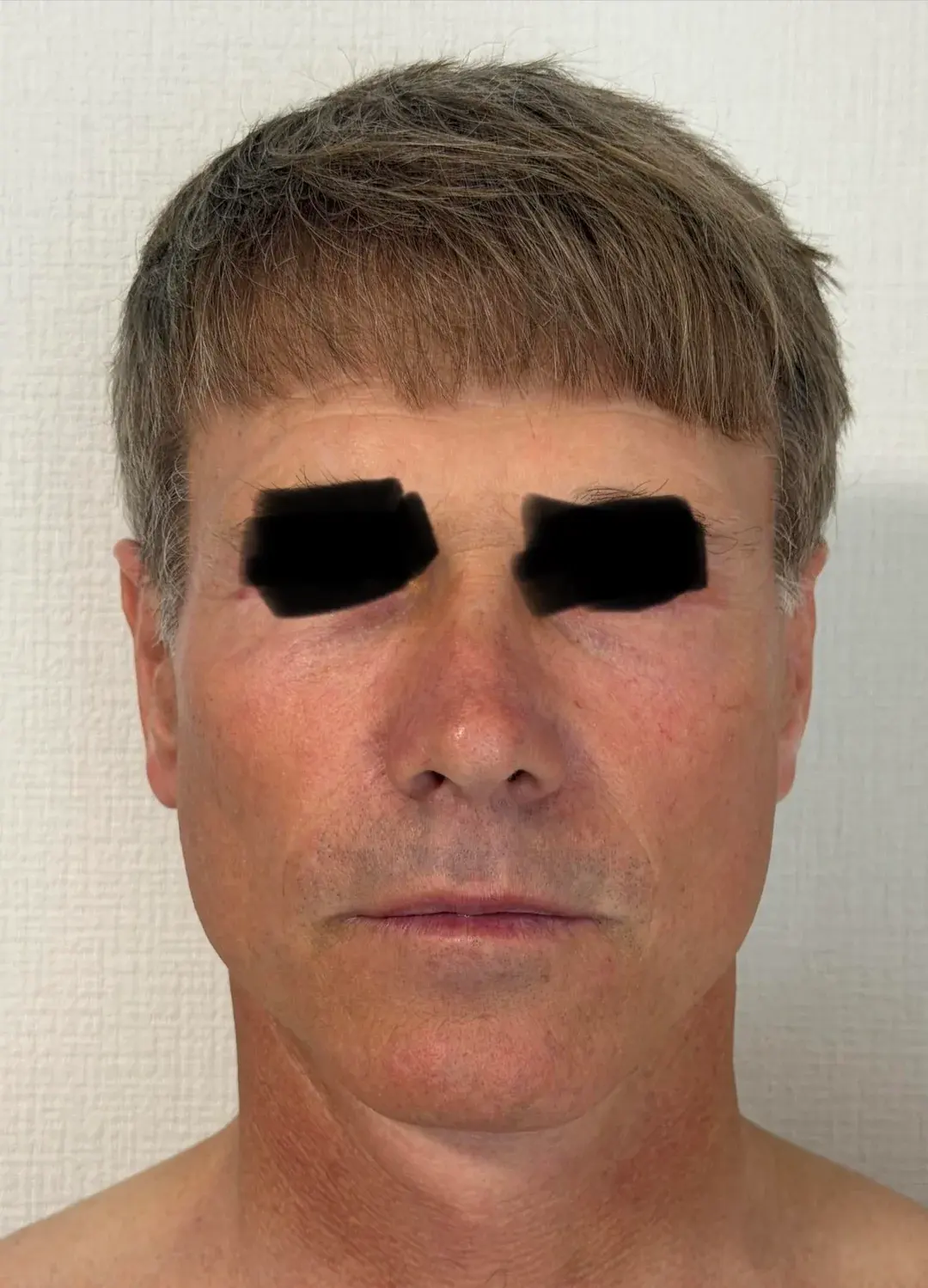 Dasipium Plastic Surgery — 1