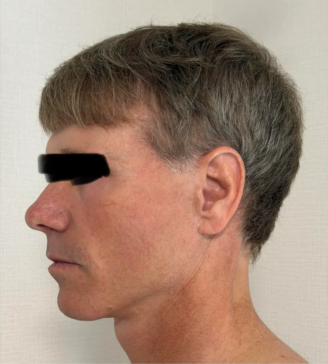 Dasipium Plastic Surgery — 2