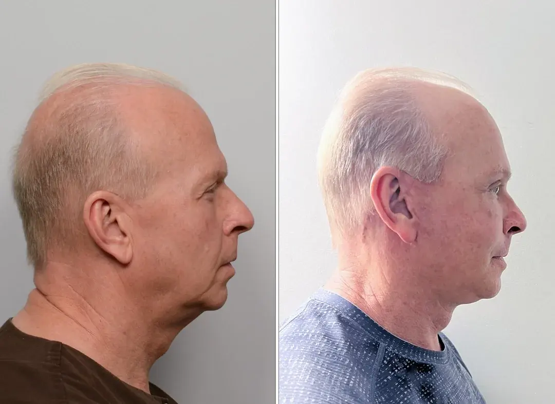 LIFF Plastic Surgery — 2