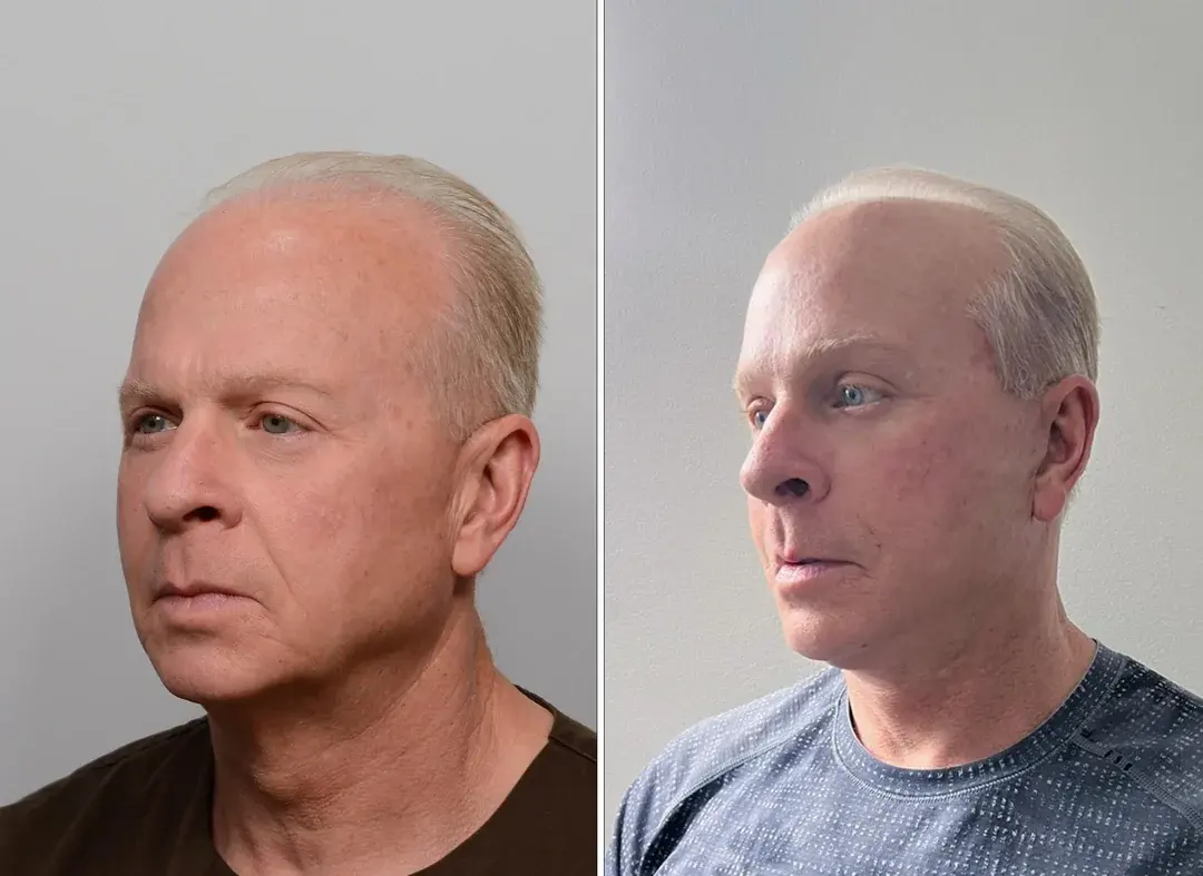 LIFF Plastic Surgery — 3