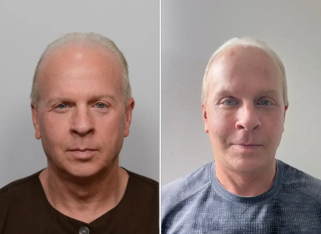 LIFF Plastic Surgery — 4