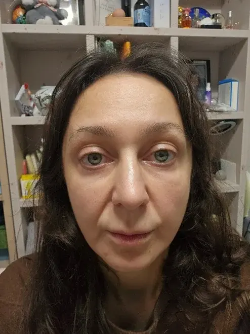AB Plastic Surgery — 1