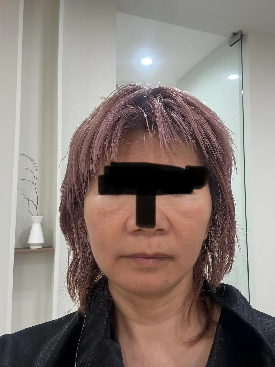Dasipium Plastic Surgery — 1