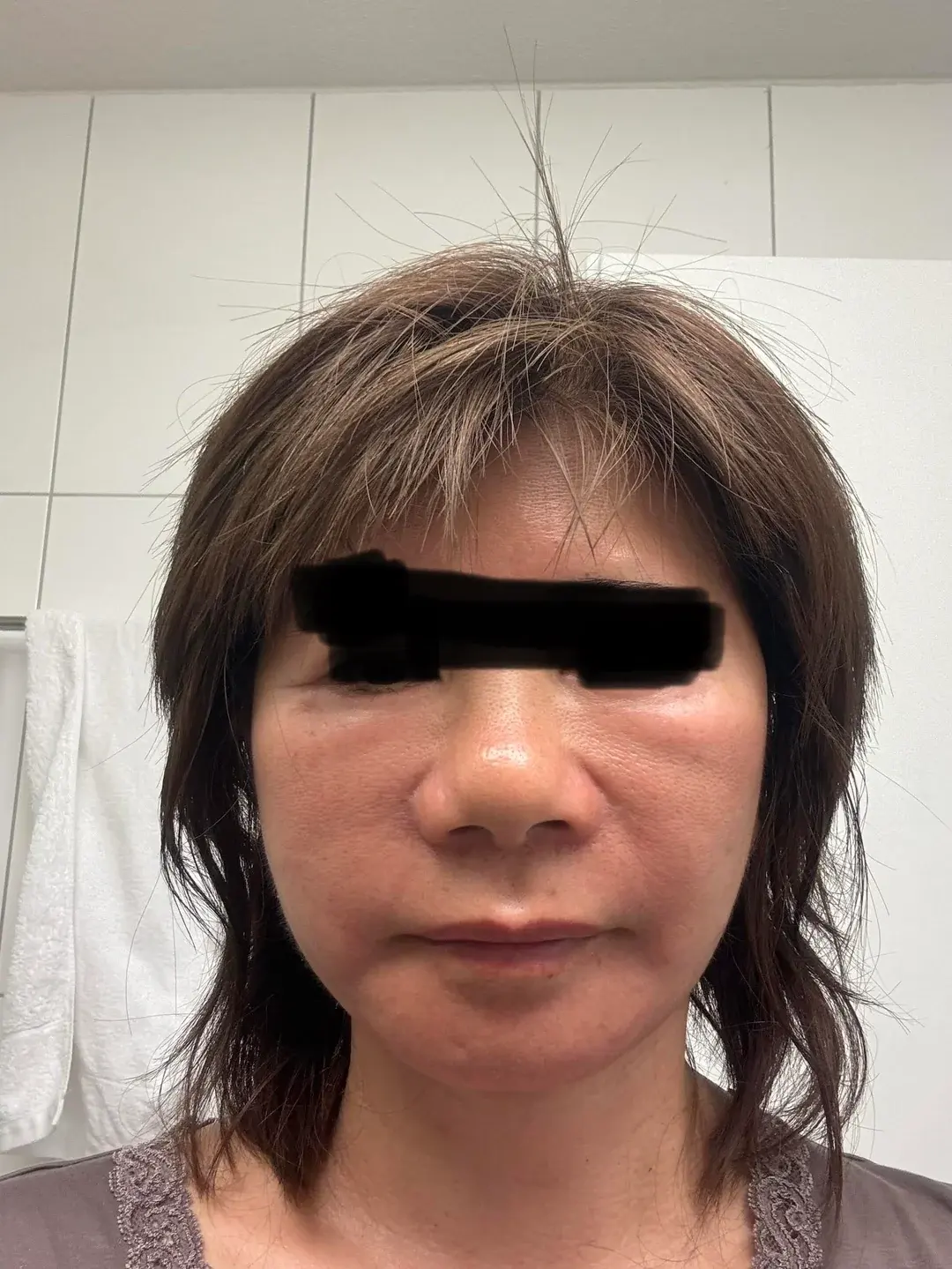 Dasipium Plastic Surgery — 2