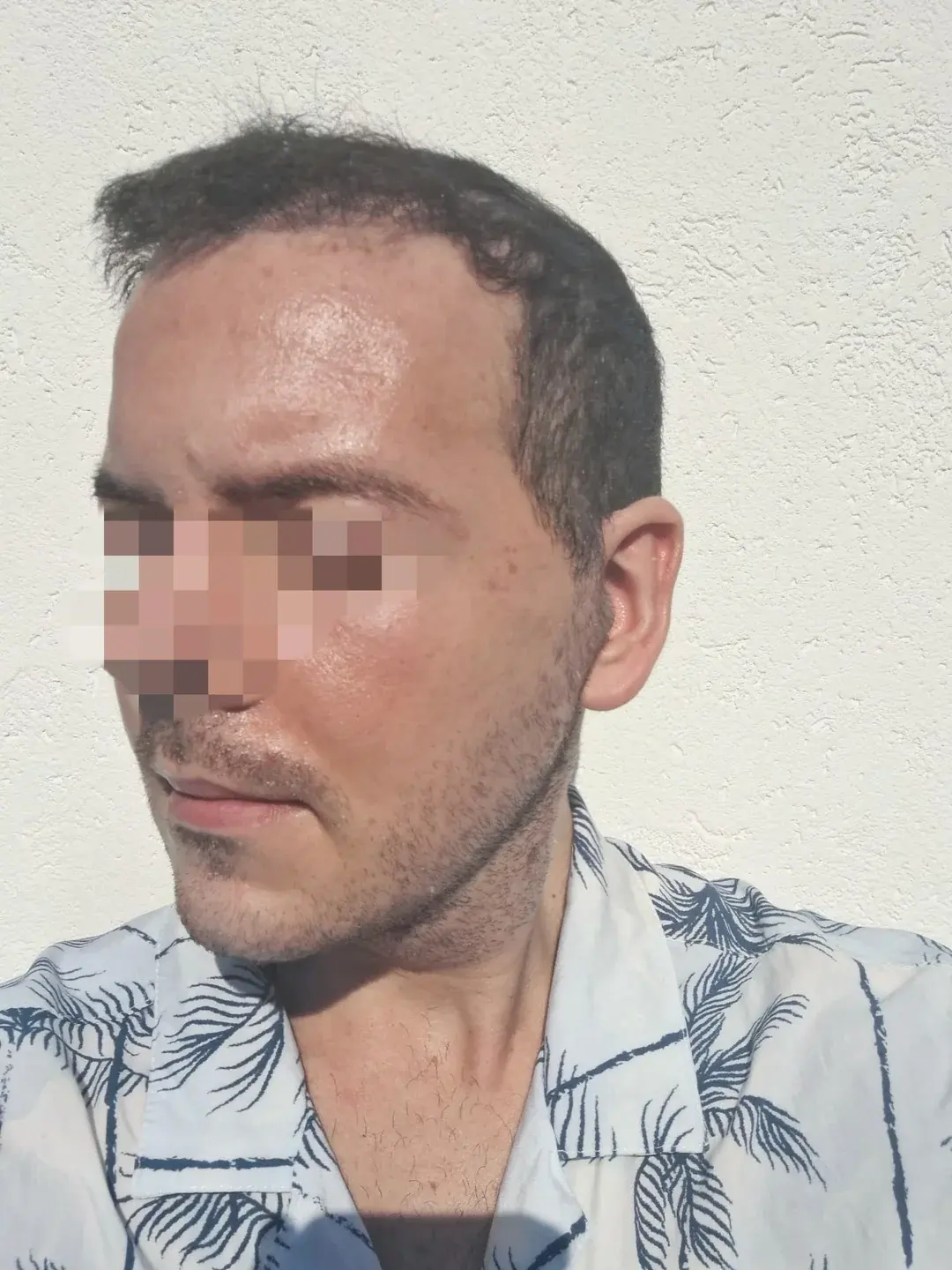 ARC Plastic Surgery — 3