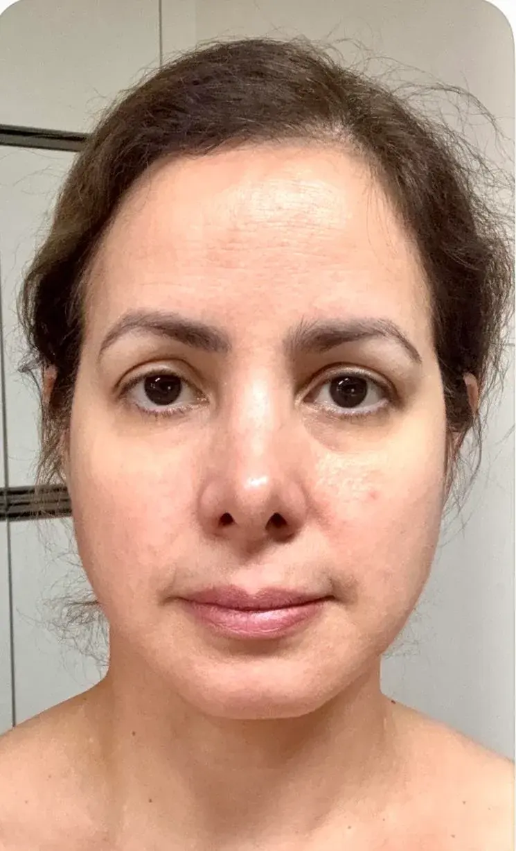 LIFF Plastic Surgery — 1