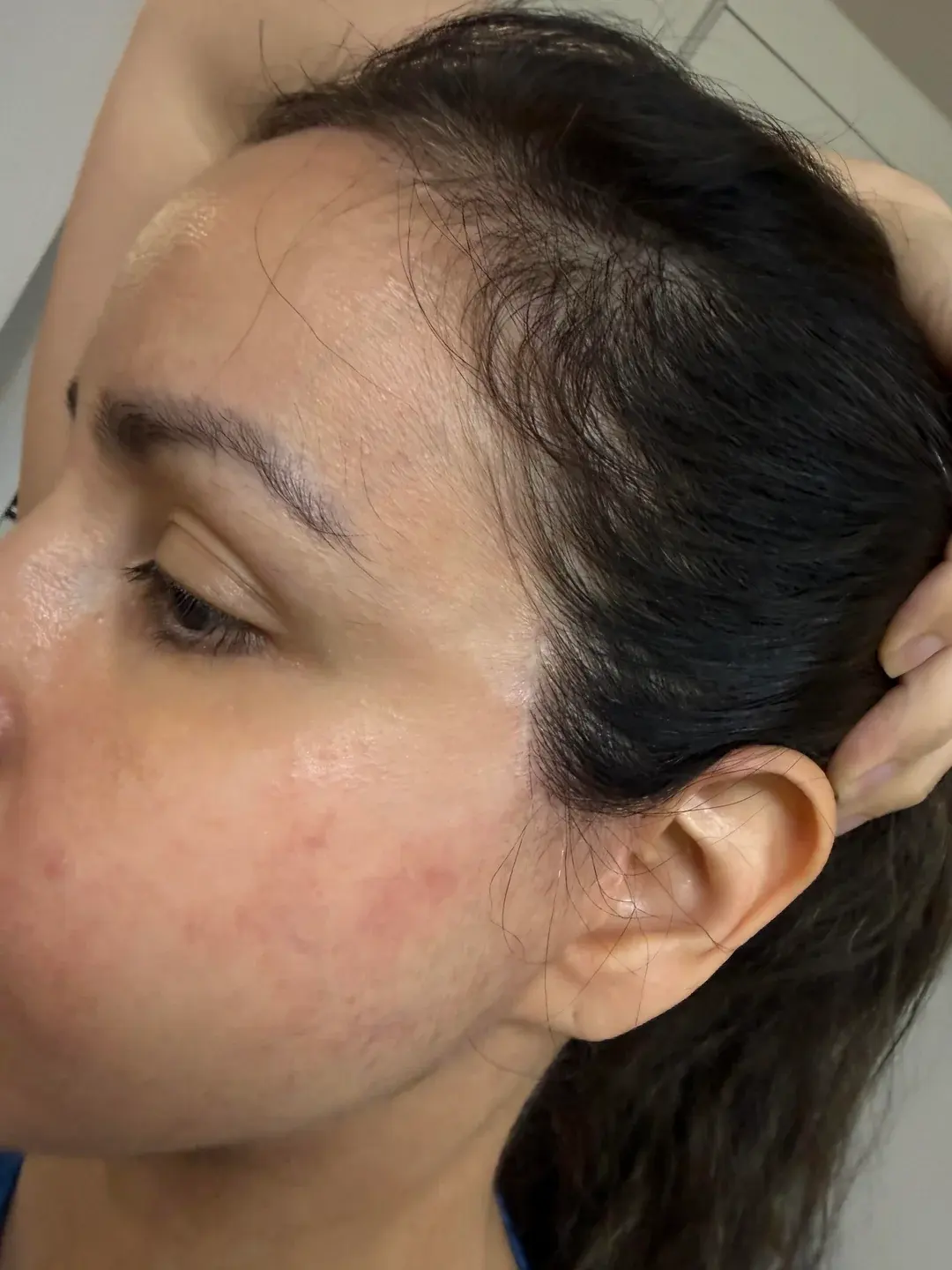 LIFF Plastic Surgery — 10