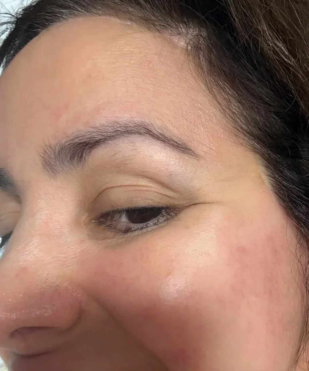 LIFF Plastic Surgery — 4