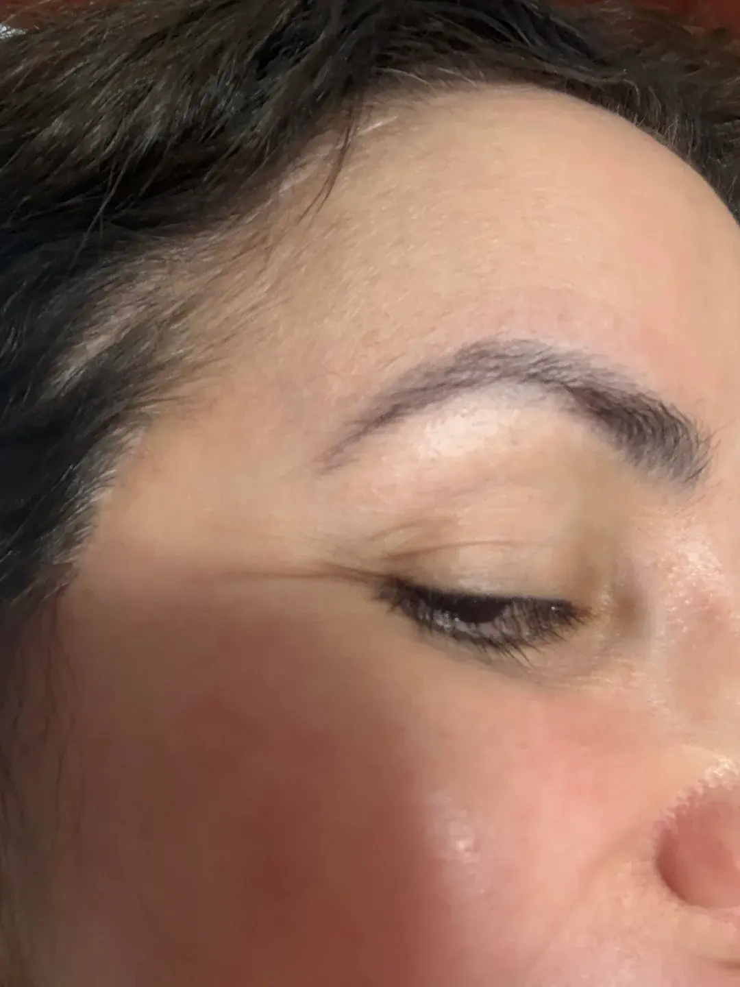 LIFF Plastic Surgery — 5