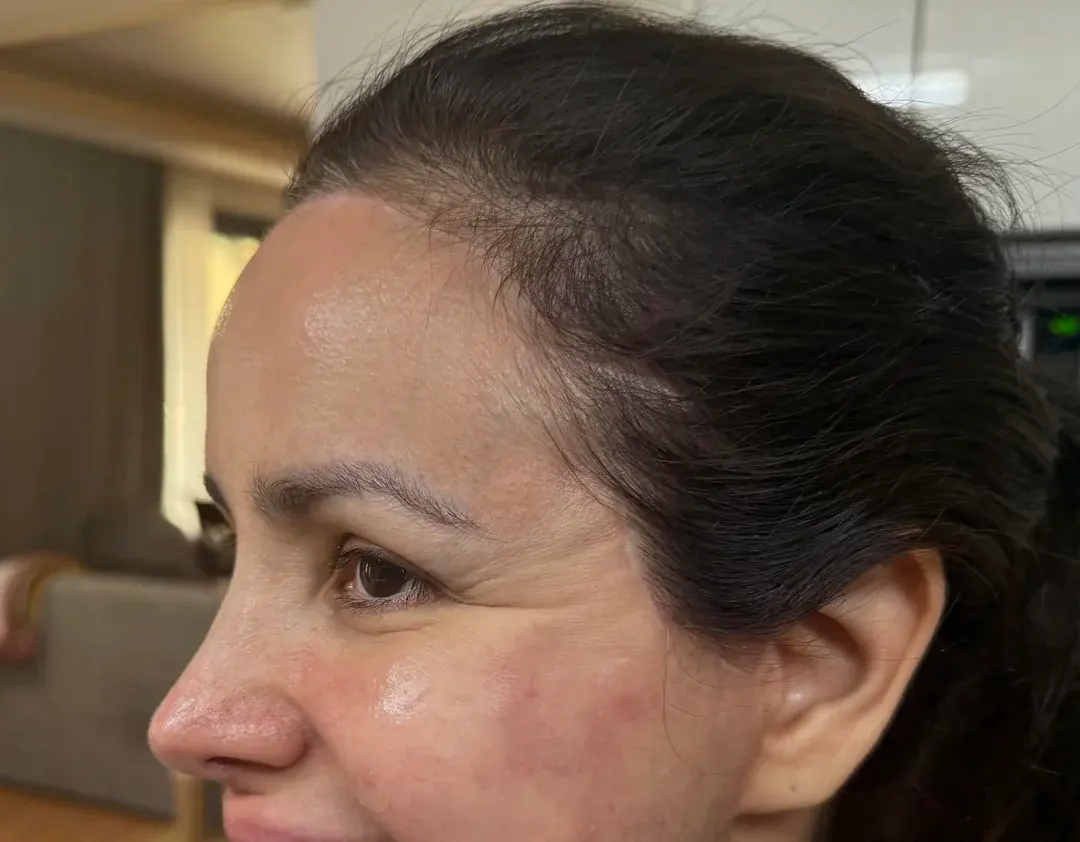 LIFF Plastic Surgery — 6