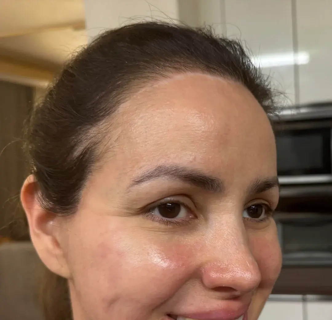LIFF Plastic Surgery — 7