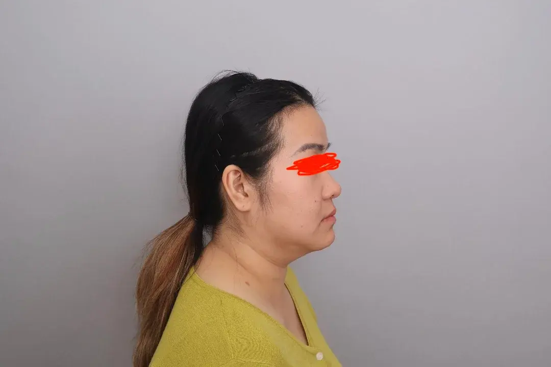 SINSANG Plastic Surgery — 1
