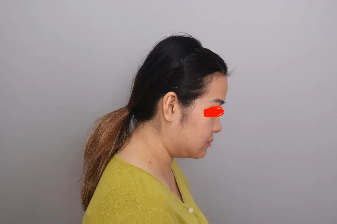 SINSANG Plastic Surgery — 2