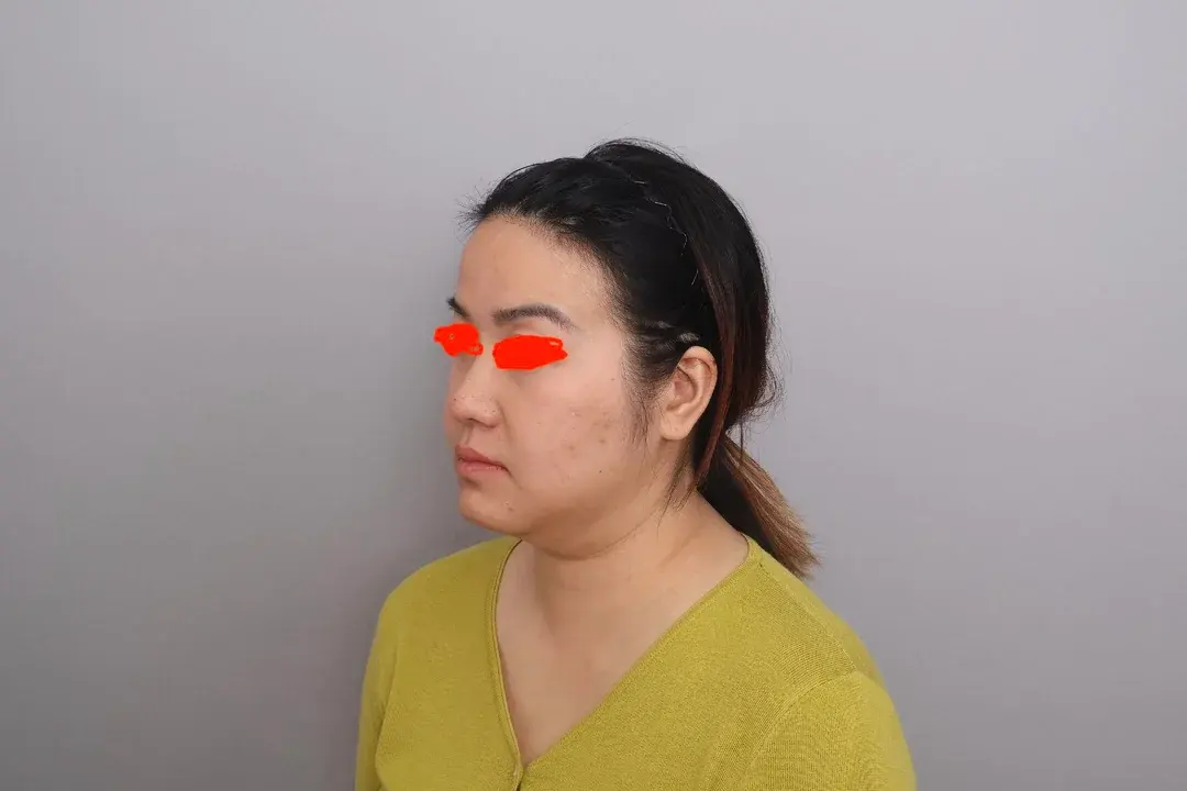 SINSANG Plastic Surgery — 3