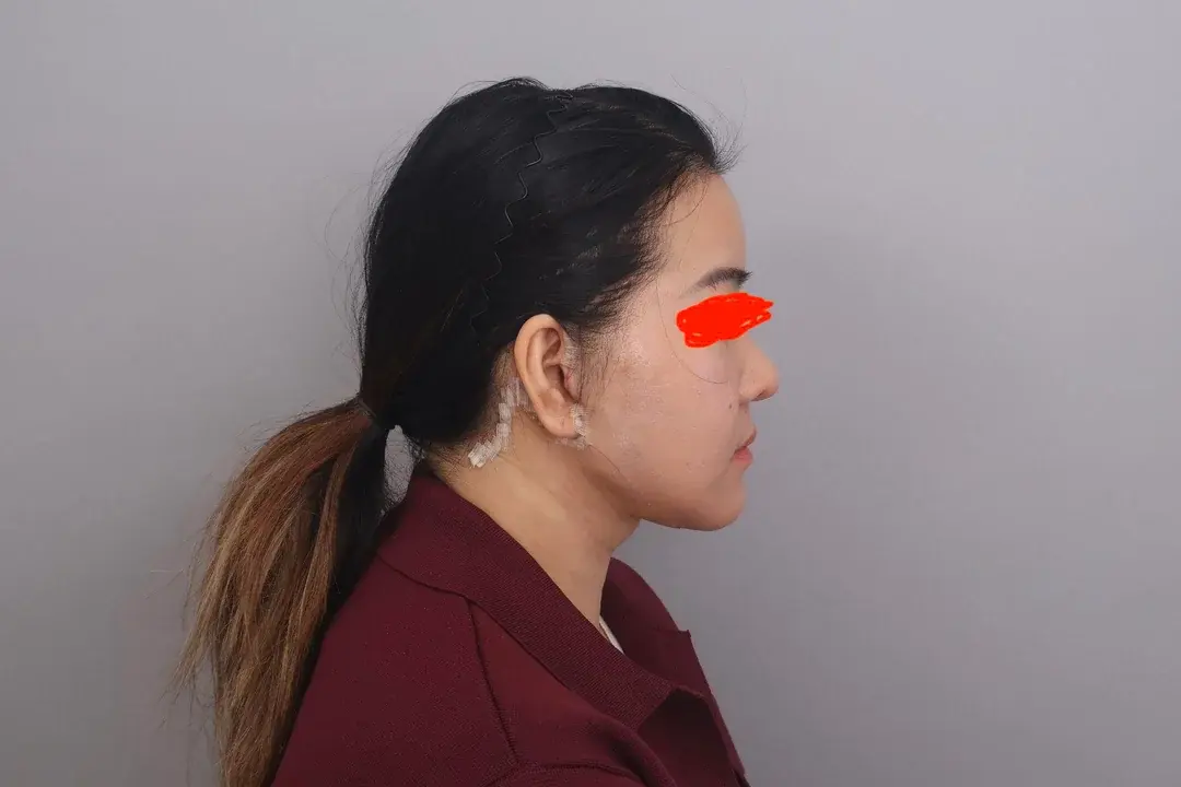 SINSANG Plastic Surgery — 4