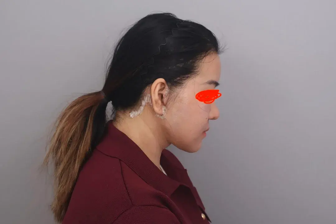 SINSANG Plastic Surgery — 5