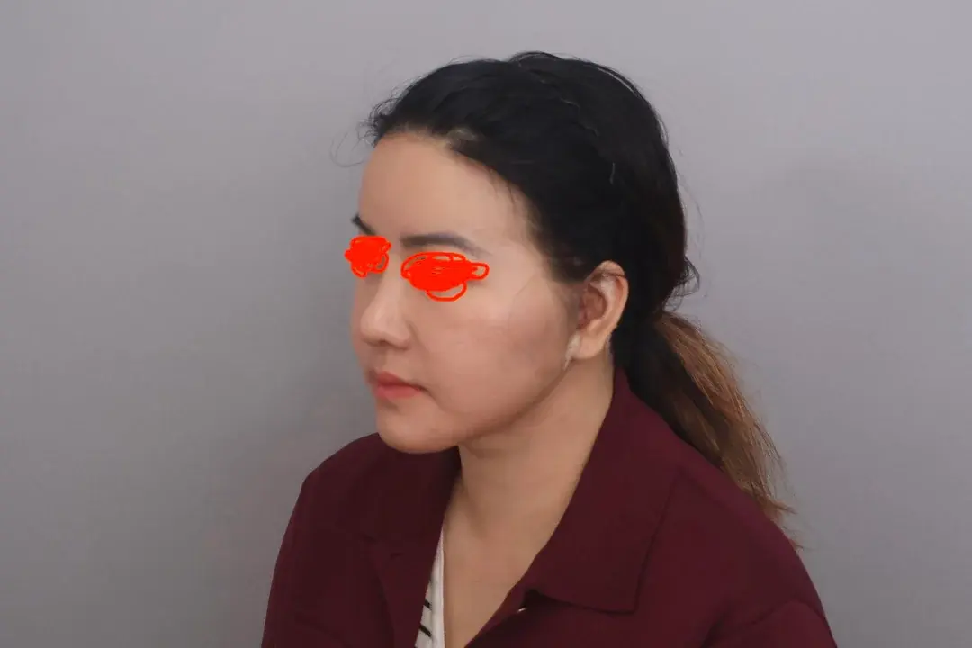 SINSANG Plastic Surgery — 6