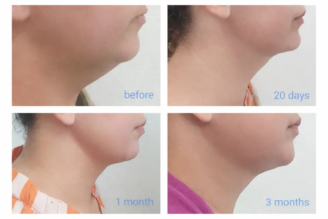 SOON PLUS Plastic Surgery — 1
