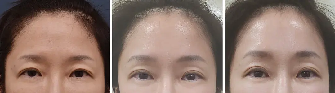 OBJET Plastic Surgery — 1