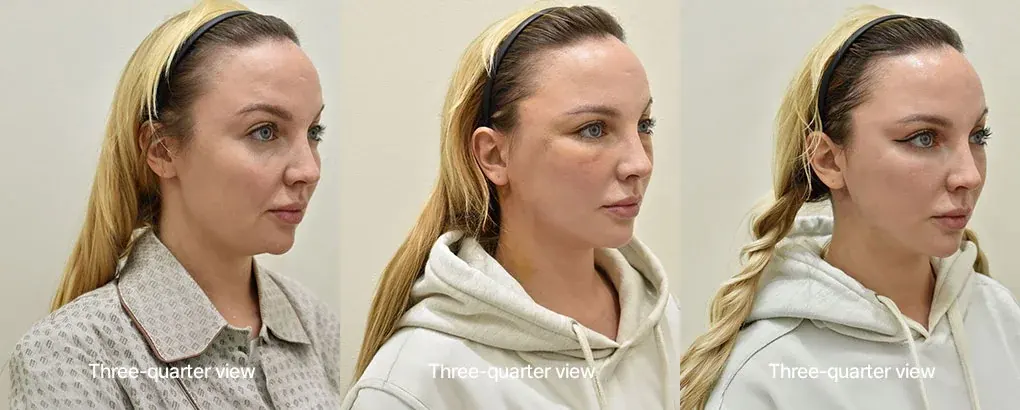 ILCHI Plastic Surgery — 1