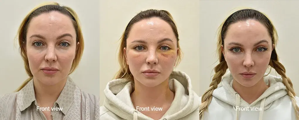 ILCHI Plastic Surgery — 2