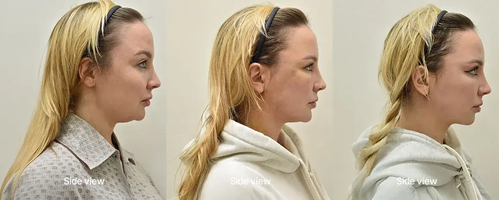 ILCHI Plastic Surgery — 3