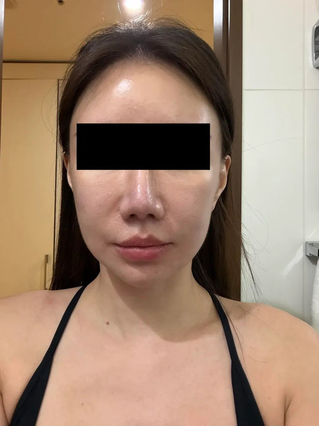 Dasipium Plastic Surgery — 1