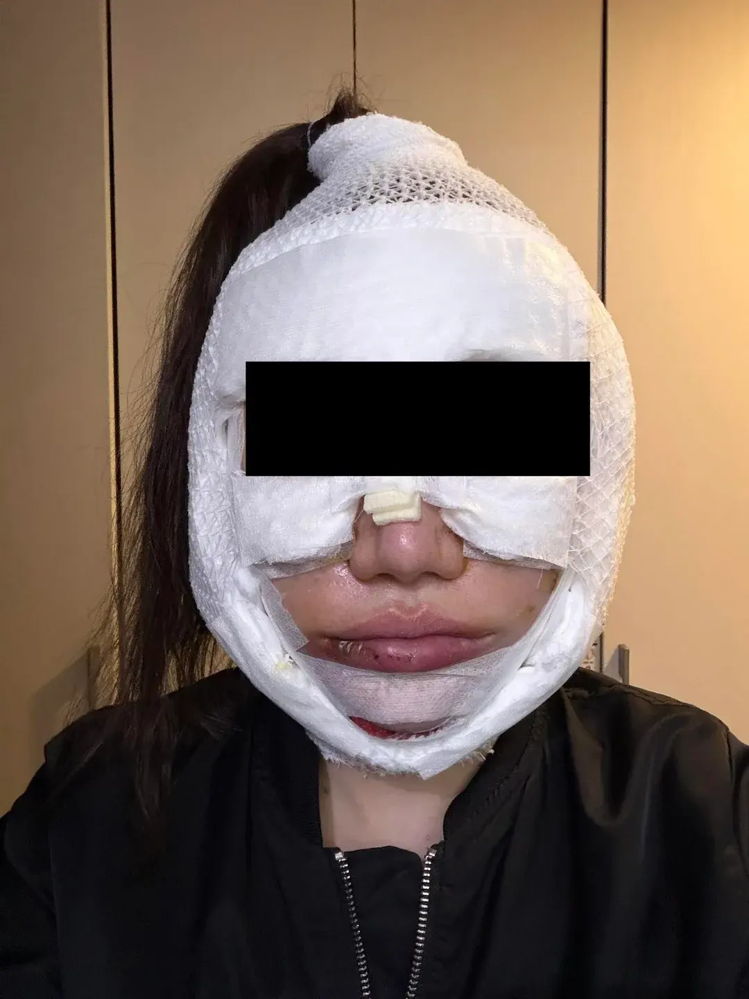 Dasipium Plastic Surgery — 3