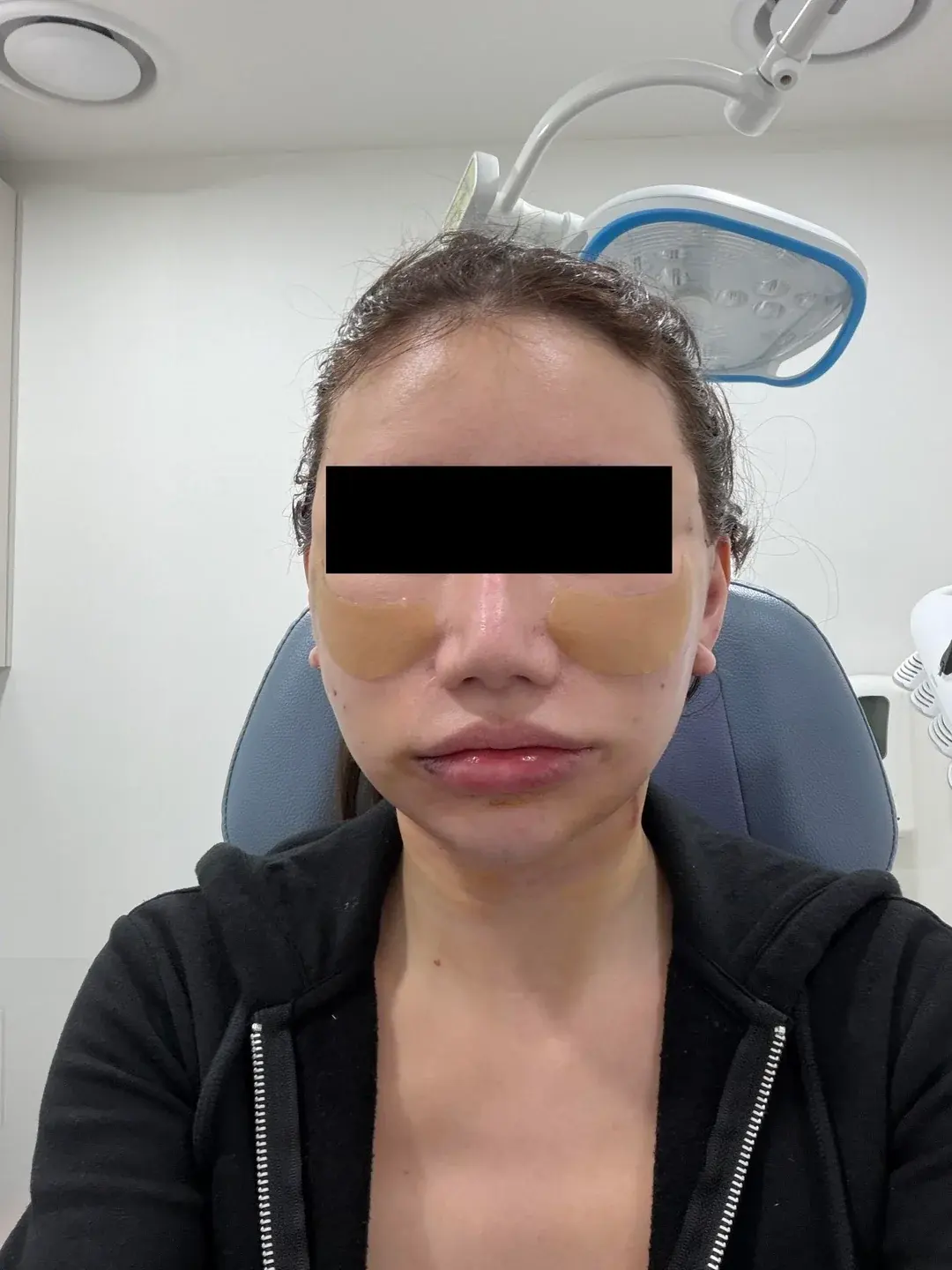 Dasipium Plastic Surgery — 4