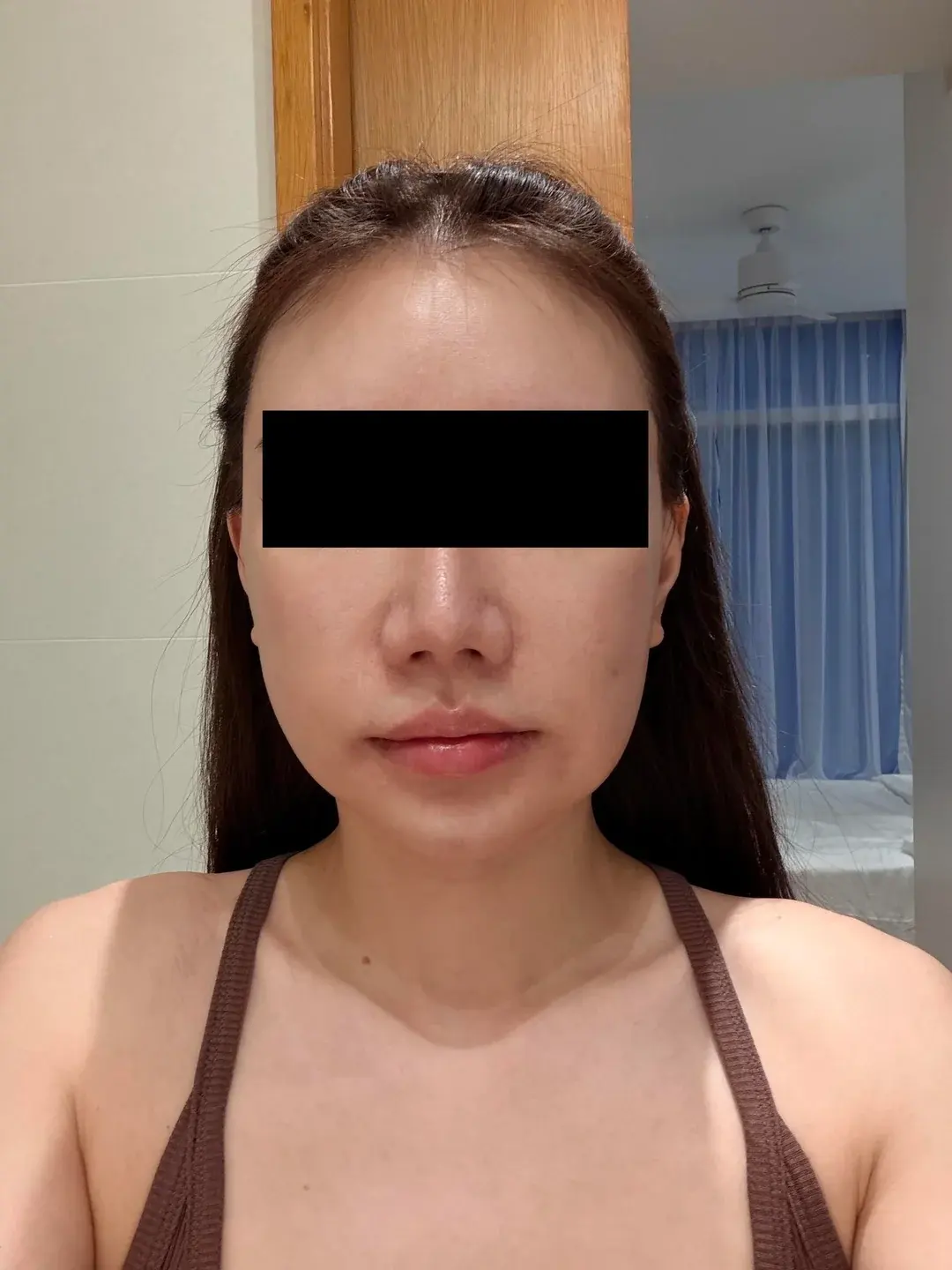 Dasipium Plastic Surgery — 5
