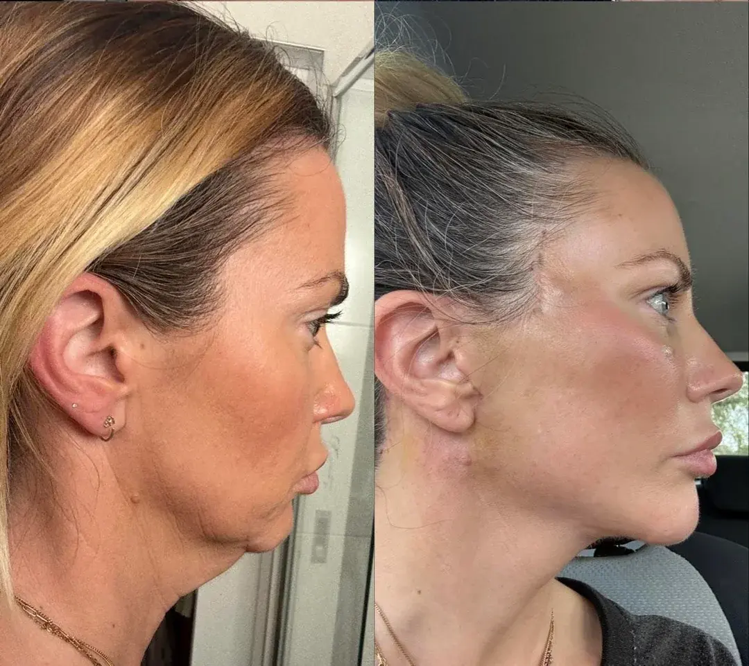 LIMO Plastic Surgery Clinic — 1