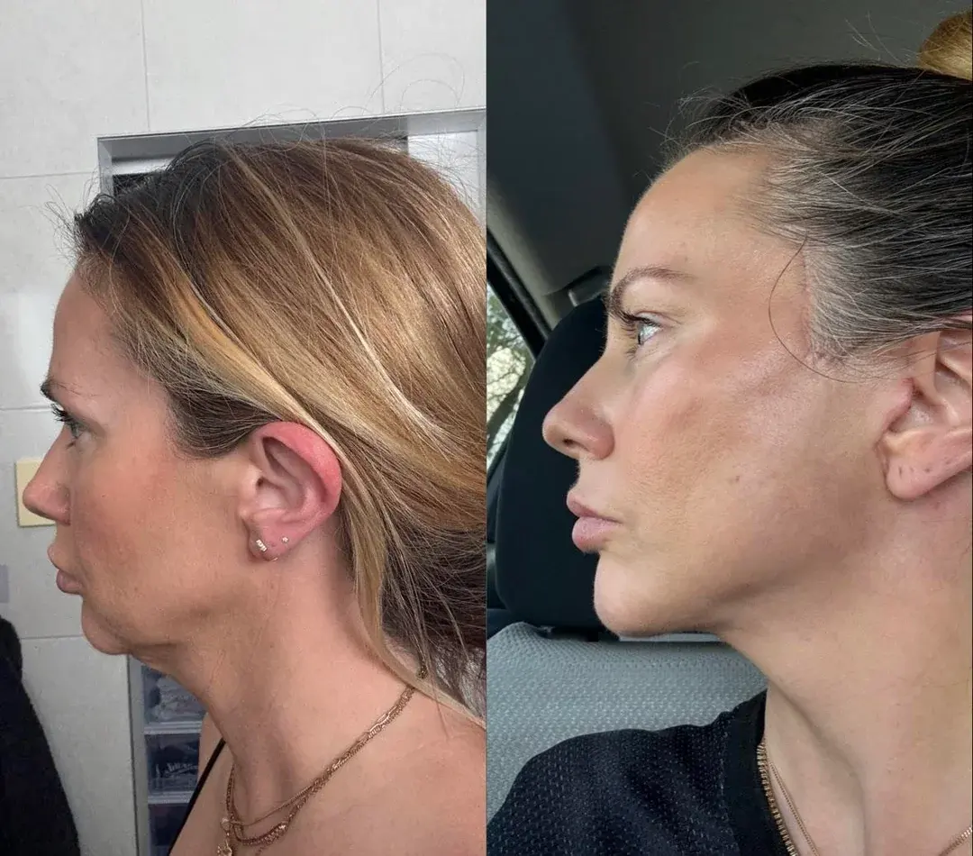 LIMO Plastic Surgery Clinic — 2