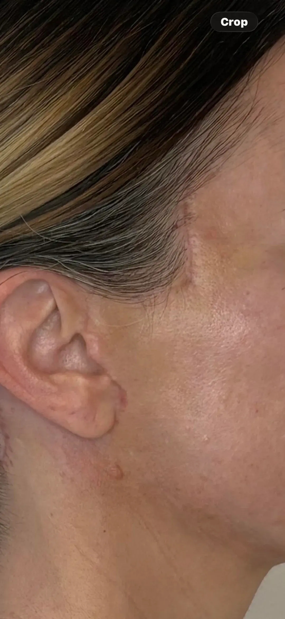 LIMO Plastic Surgery Clinic — 4