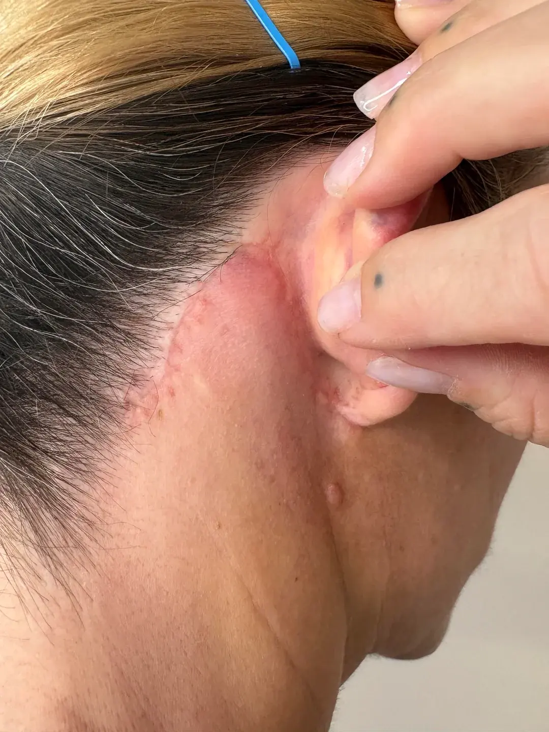 LIMO Plastic Surgery Clinic — 5
