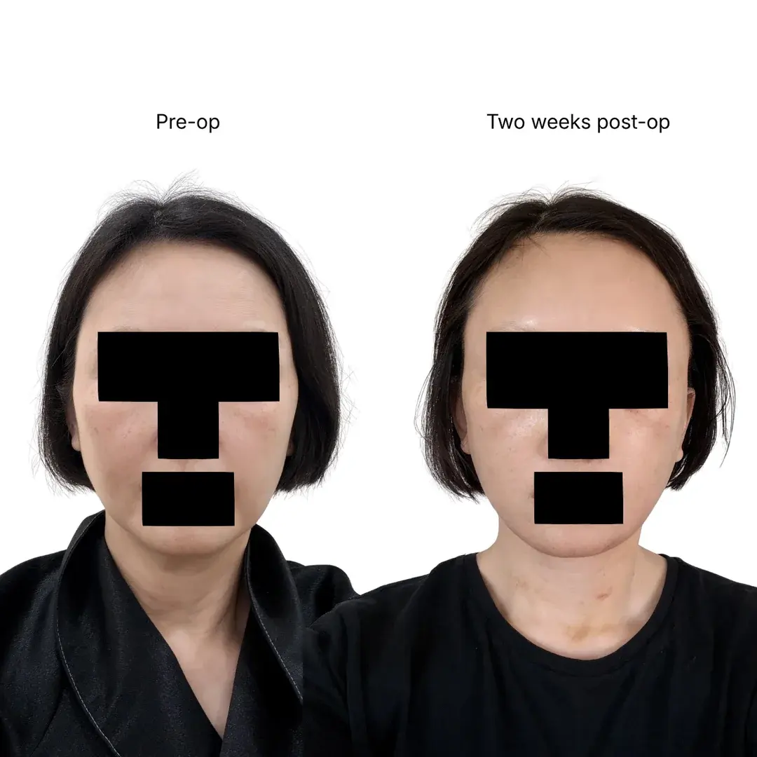 Dasipium Plastic Surgery — 1